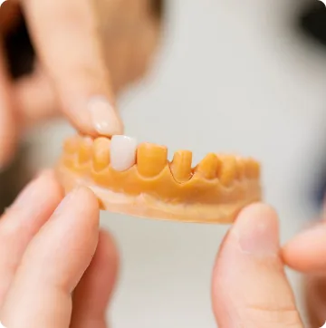 將假牙對準牙齒模型確認的樣子